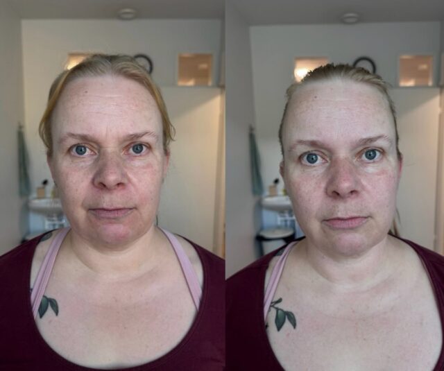 Vau mitä tuloksia Faceform Massage™️ hoidolla! 😍Kasvojen ilme on paljon rennompi, nesteet lähteneet liikkeelle ja juonteetkin madaltuneet.Paras palaute on kuitenkin aina se, että asiakkaat kokevat saavansa hyvin rentouttavan hetken itselleen. 🫶🏻#faceformmassage #faceformmassagefinland